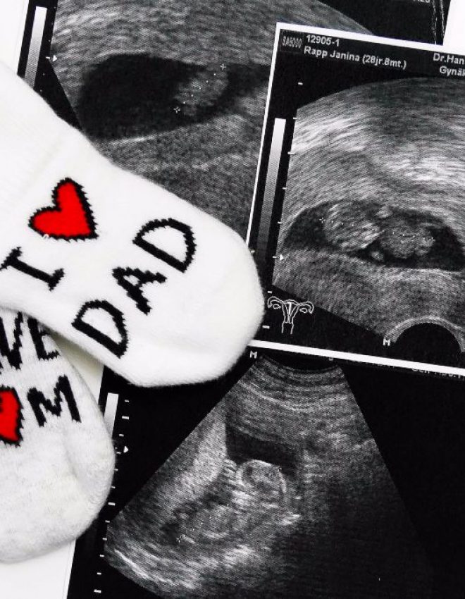 #1st Trimester – Wir bekommen ein Baby!